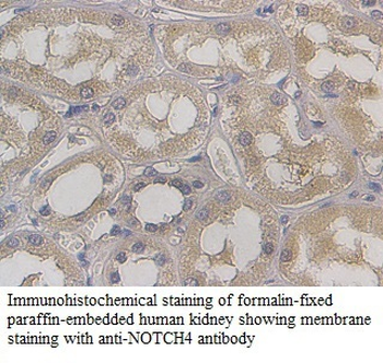 NOTCH4 Rabbit Polyclonal Antibody