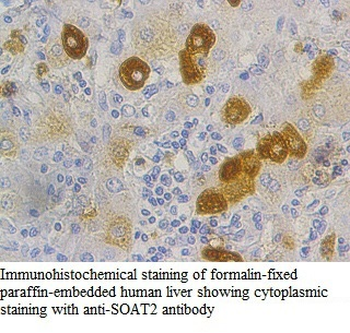 SOAT2 Rabbit Polyclonal Antibody