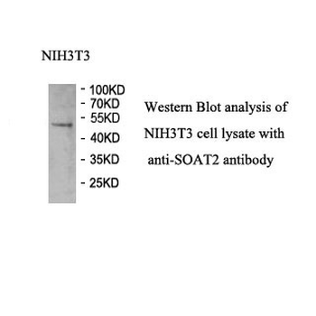 SOAT2 Rabbit Polyclonal Antibody