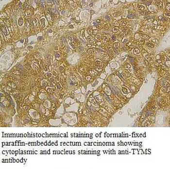 TYMS Rabbit Polyclonal Antibody