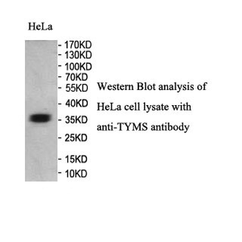 TYMS Rabbit Polyclonal Antibody