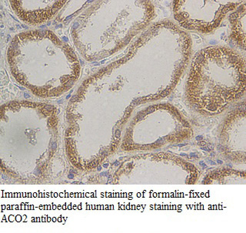 ACO2 Rabbit Polyclonal Antibody