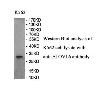 ELOVL6 Rabbit Polyclonal Antibody