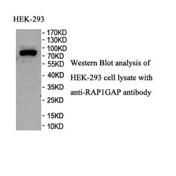 RAP1GAP Rabbit Polyclonal Antibody