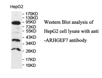 ARHGEF7 Rabbit Polyclonal Antibody