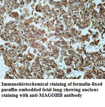 ASF1A Rabbit Polyclonal Antibody