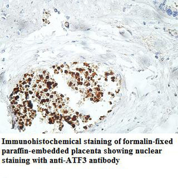 ATF3 Rabbit Polyclonal Antibody