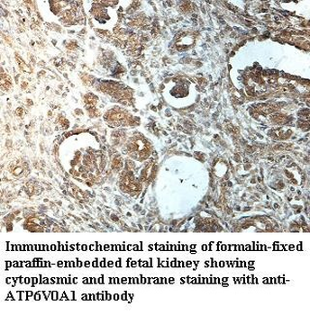 ATP6V0A1 Rabbit Polyclonal Antibody