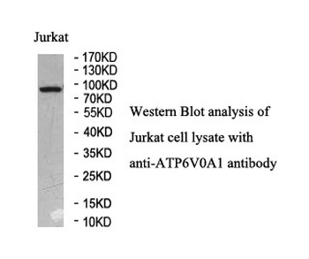 ATP6V0A1 Rabbit Polyclonal Antibody
