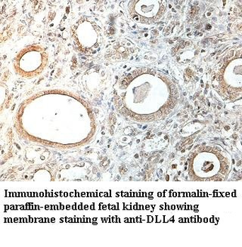 DLL4 Rabbit Polyclonal Antibody