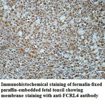 FCRL4 Rabbit Polyclonal Antibody