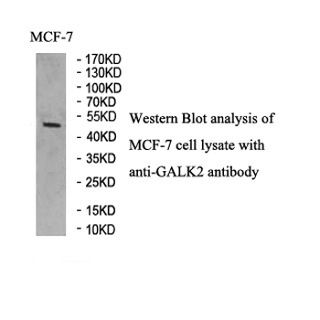 GALK2 Rabbit Polyclonal Antibody