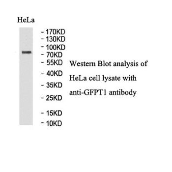 GFPT1 Rabbit Polyclonal Antibody