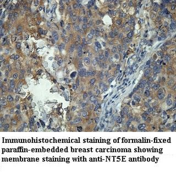 NT5E Rabbit Polyclonal Antibody