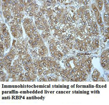 RBP4 Rabbit Polyclonal Antibody