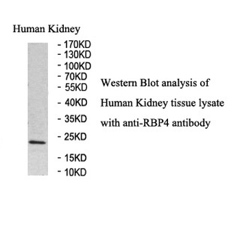 RBP4 Rabbit Polyclonal Antibody
