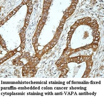 VAPA Rabbit Polyclonal Antibody