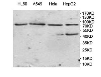 VWA2 Rabbit Polyclonal Antibody
