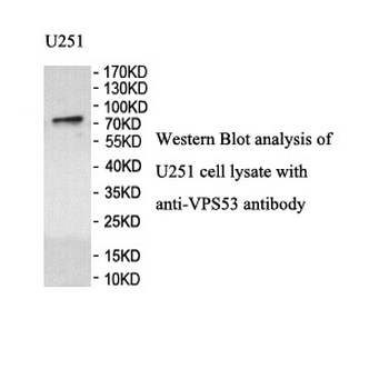VPS53 Rabbit Polyclonal Antibody