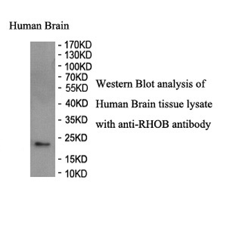 RHOB Rabbit Polyclonal Antibody
