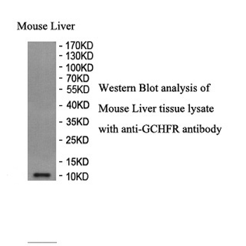 GCHFR Rabbit Polyclonal Antibody