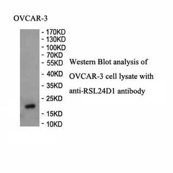 RSL24D1 Rabbit Polyclonal Antibody
