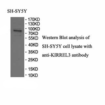 KIRREL3 Rabbit Polyclonal Antibody