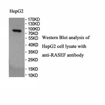 RASEF Rabbit Polyclonal Antibody