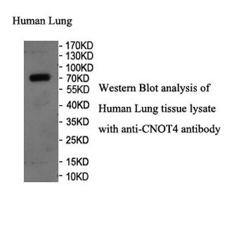 CNOT4 Rabbit Polyclonal Antibody