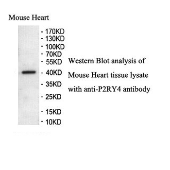 P2RY4 Rabbit Polyclonal Antibody