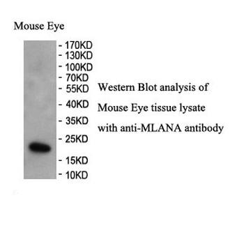 MLANA Rabbit Polyclonal Antibody
