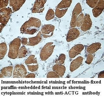 ACTG Rabbit Polyclonal Antibody