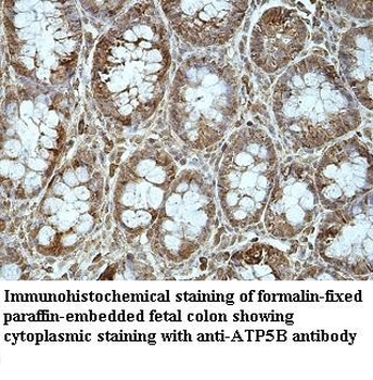 ATP5B Rabbit Polyclonal Antibody