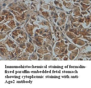 AGO2 Rabbit Polyclonal Antibody