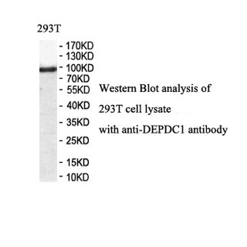 DEPDC1 Rabbit Polyclonal Antibody