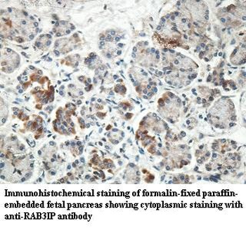 RAB3IP Rabbit Polyclonal Antibody