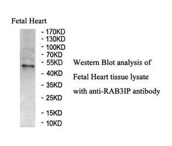RAB3IP Rabbit Polyclonal Antibody