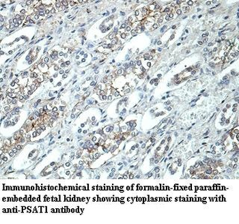 PSAT1 Rabbit Polyclonal Antibody