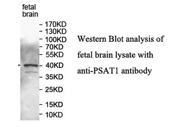 PSAT1 Rabbit Polyclonal Antibody