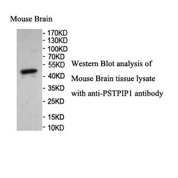 PSTPIP1 Rabbit Polyclonal Antibody