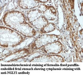 NGLY1 Rabbit Polyclonal Antibody