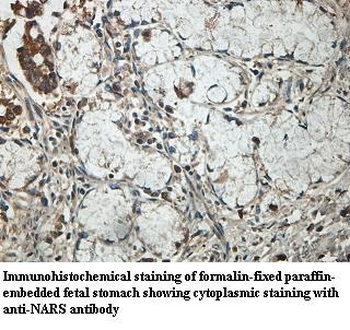 NARS Rabbit Polyclonal Antibody