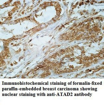 ATAD2 Rabbit Polyclonal Antibody