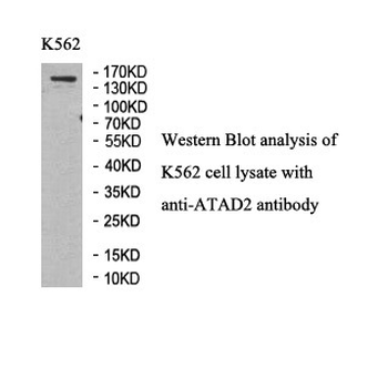 ATAD2 Rabbit Polyclonal Antibody