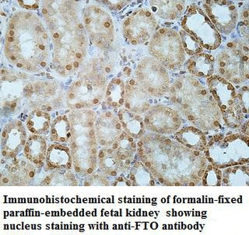 FTO Rabbit Polyclonal Antibody