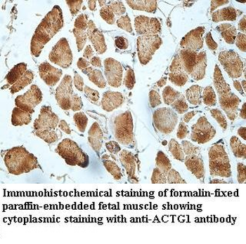 ACTG1 Rabbit Polyclonal Antibody