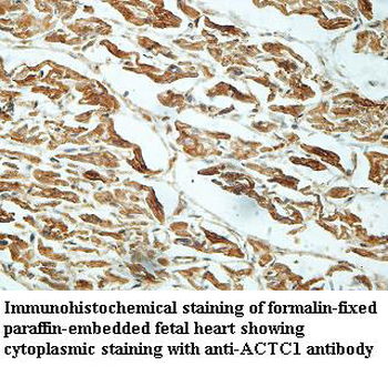 ACTC1 Rabbit Polyclonal Antibody