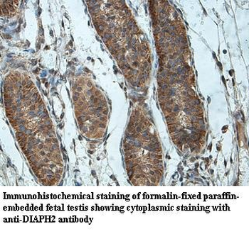 DIAPH2 Rabbit Polyclonal Antibody