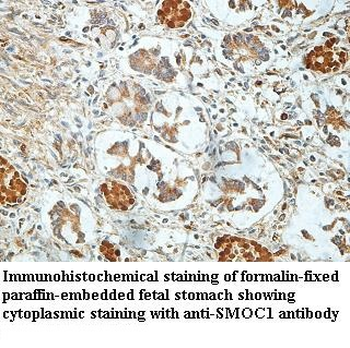 SMOC1 Rabbit Polyclonal Antibody