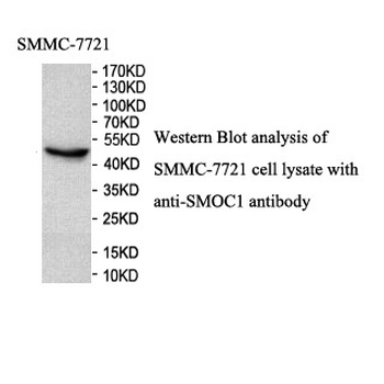 SMOC1 Rabbit Polyclonal Antibody